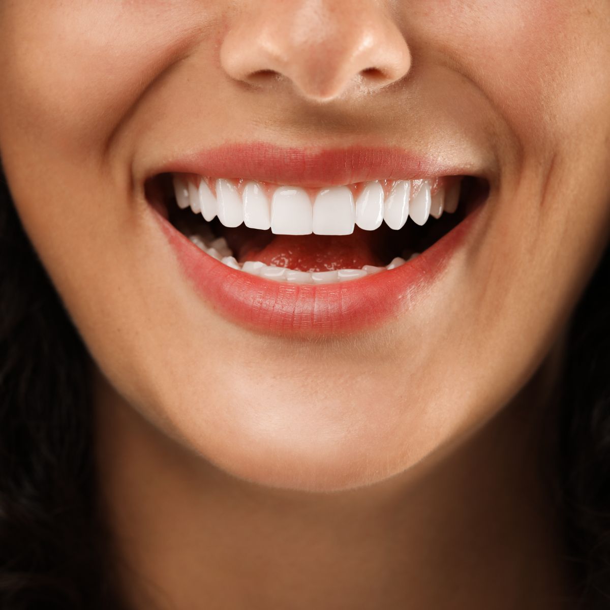 estetica-sorriso